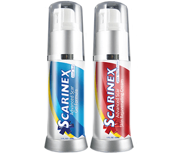 Consumer Health Scarinex Review - For Reducing The Appearance Of Scars