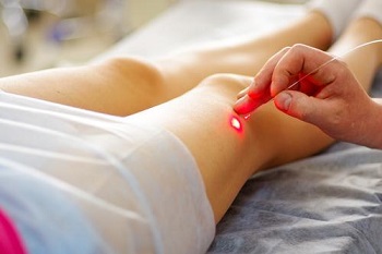 Laser Therapy for Varicose Veins